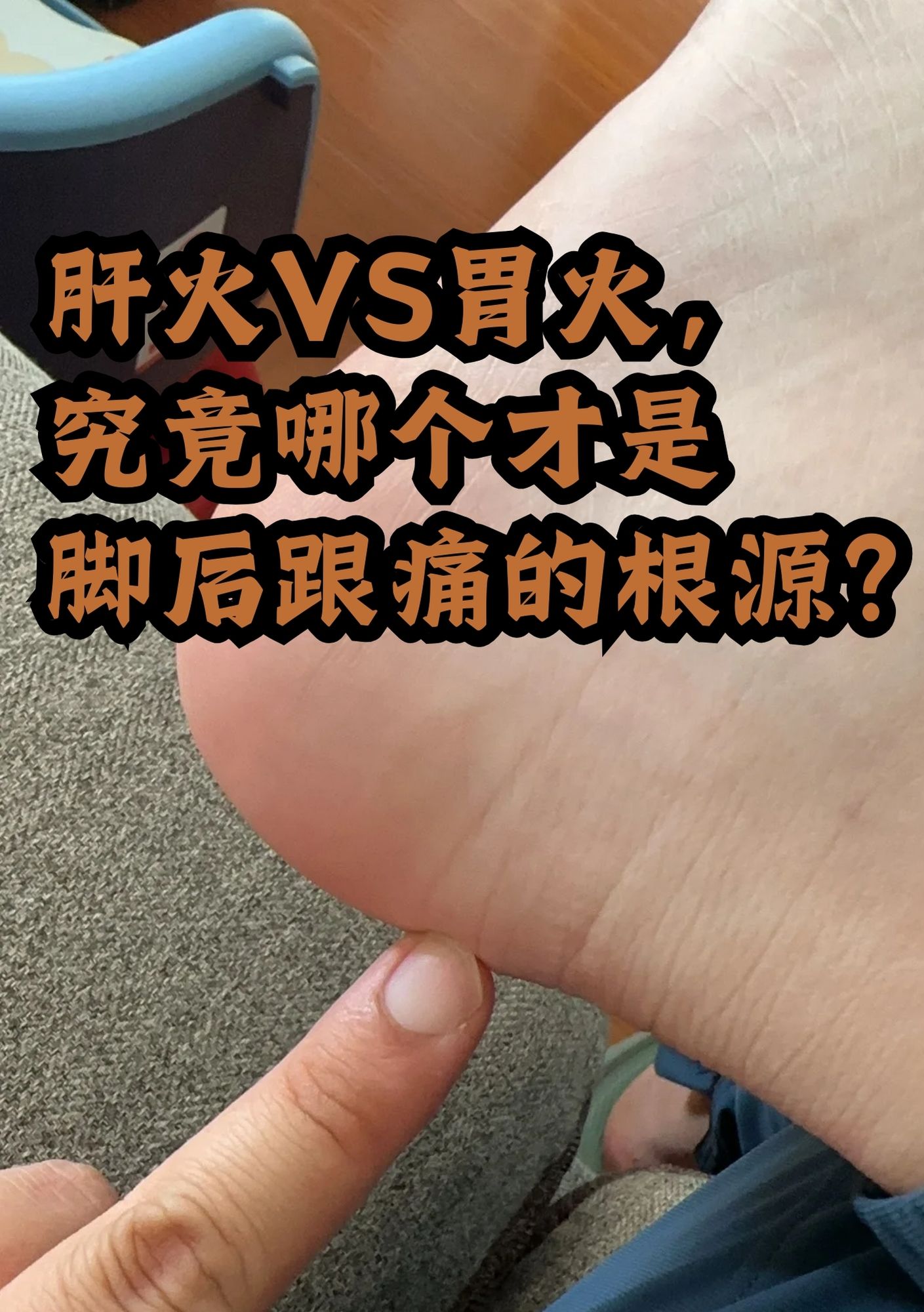 脚后跟疼痛与肝火胃火无关，真正原因在这里