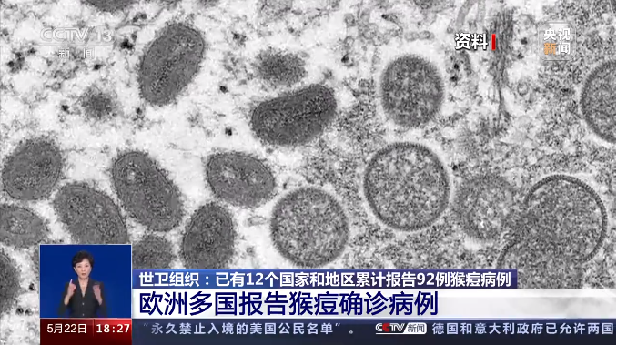 猴痘又称为“猴天花”，已发生人际传播，对人类的危害有多大？