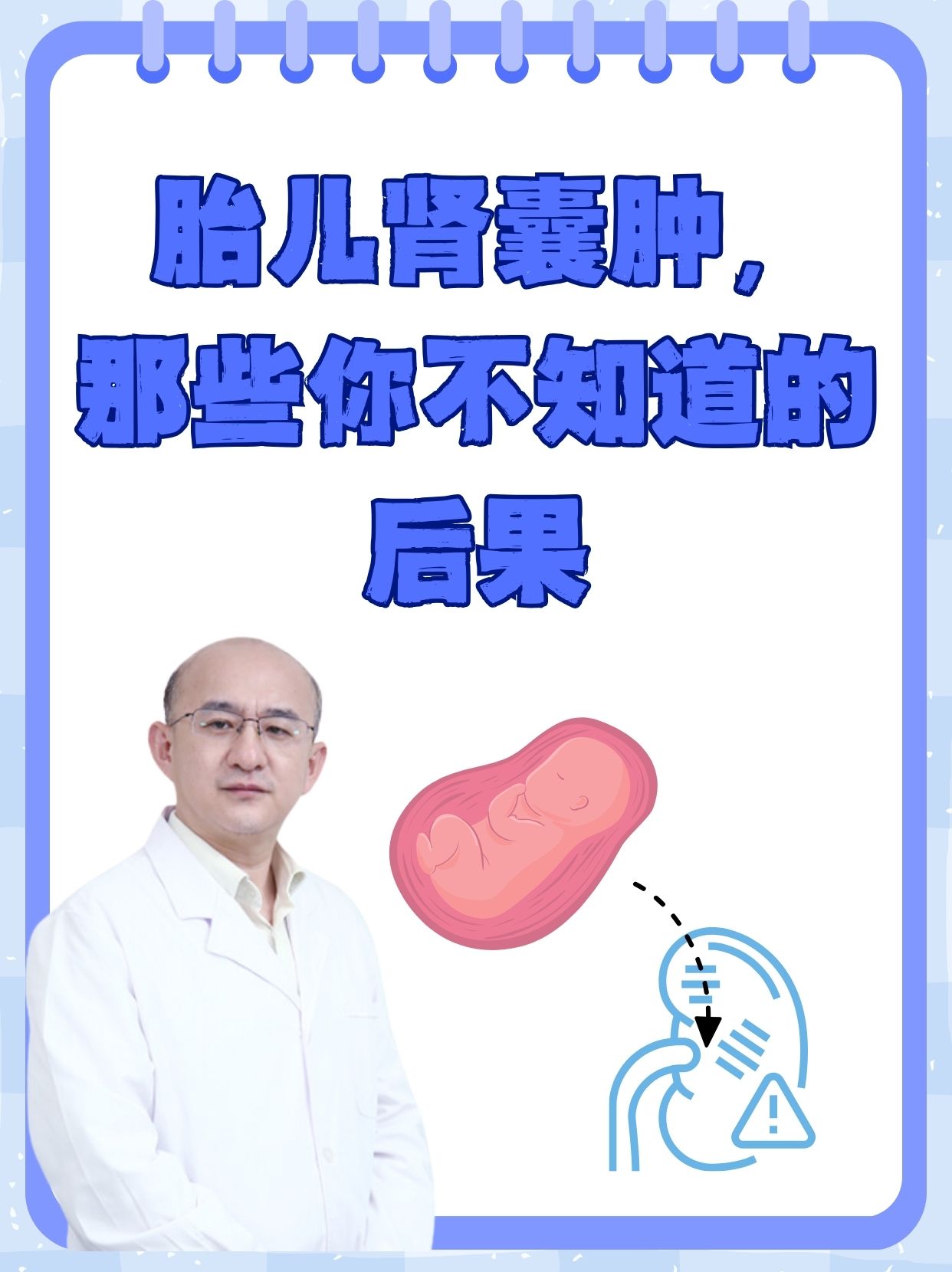 胎儿肾脏囊性病变：了解影响与应对策略