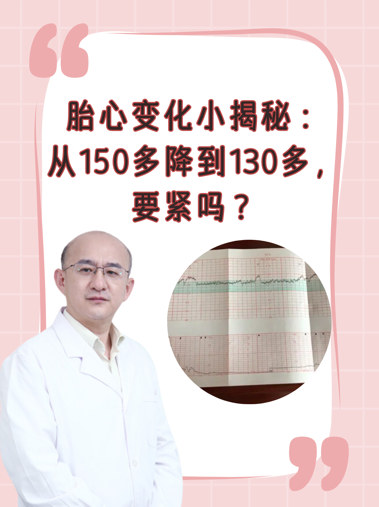 胎心率从150降到130，孕妈妈需要担心吗？