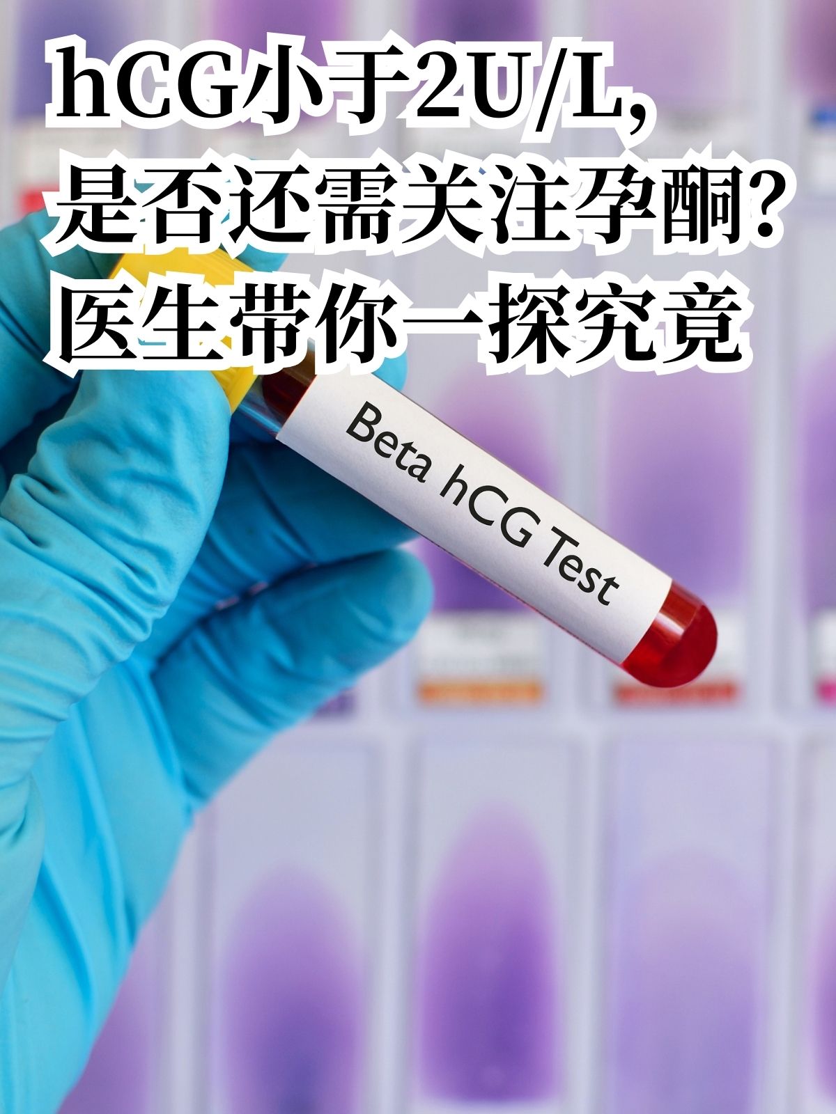 hCG低于2 U/L，孕酮还需关注吗？健康科普为你解答