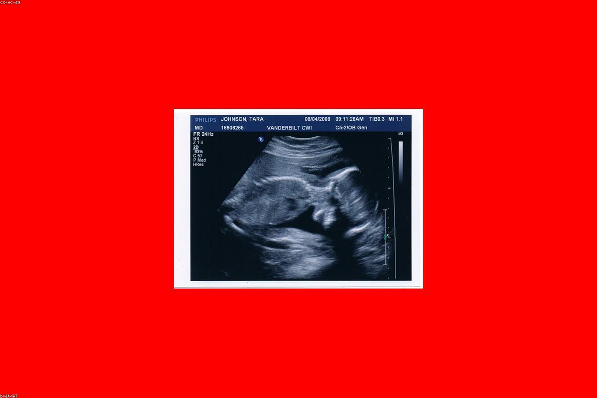 深圳三代试管婴儿医院对比：深圳市妇幼保健院与香港大学深圳医院怎么选